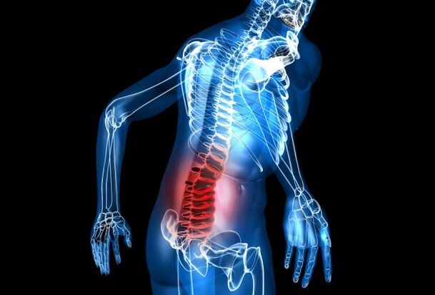 Symptoms of osteochondrosis