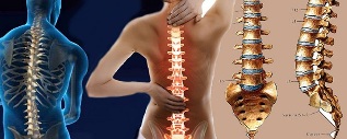how does osteochondrosis of the neck develop