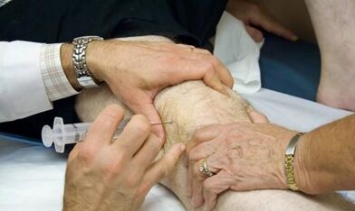 How to distinguish arthrosis from arthrosis